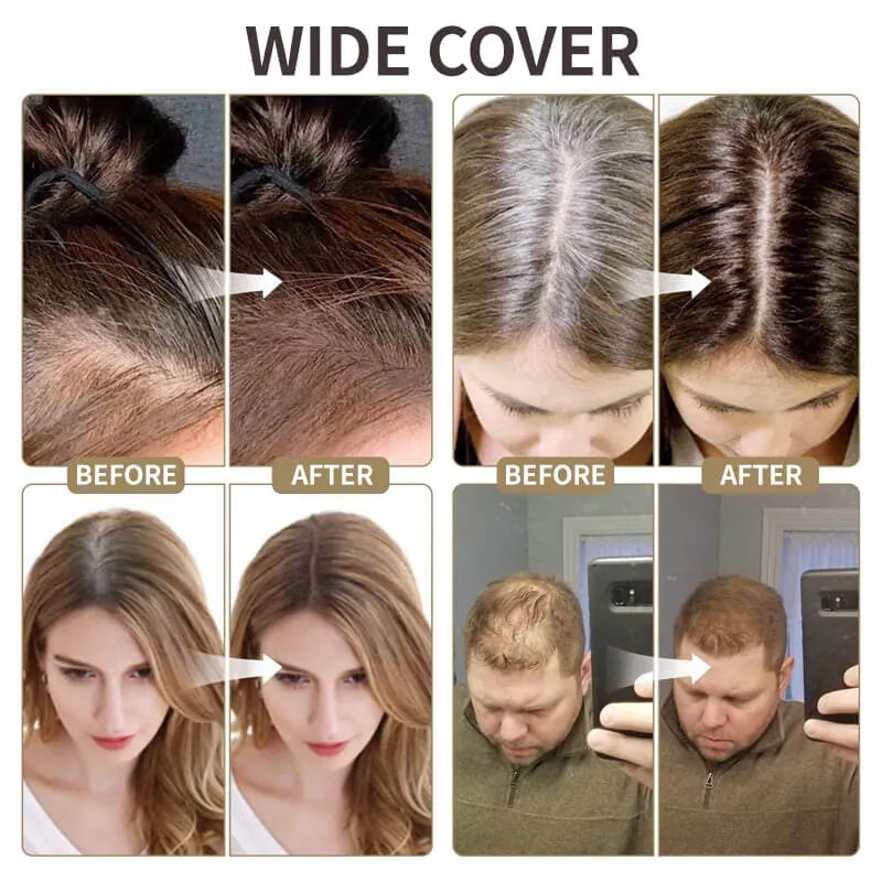 2025 New Upgraded Magic Root Cover Up